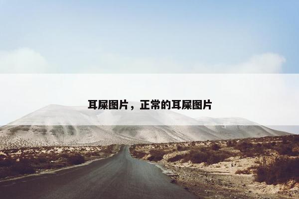 耳屎图片，正常的耳屎图片
