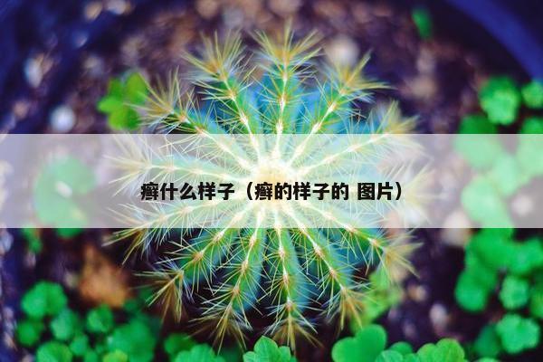 癣什么样子（癣的样子的 图片）
