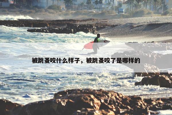 被跳蚤咬什么样子，被跳蚤咬了是哪样的