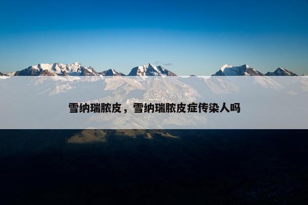 雪纳瑞脓皮，雪纳瑞脓皮症传染人吗